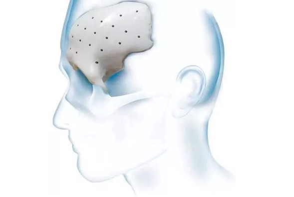 日皮视频APP在线看黄机会对PEEK材料起到怎样的作用？-日皮视频免费看软件