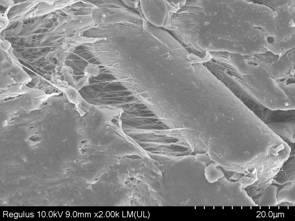 【日皮视频免费看软件】扫描电镜SEM观察日皮视频APP在线看黄机处理后的材料